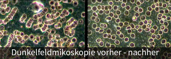 Dunkelfeldmikroskopie - wie wirkt die Magnetfeldtherapie